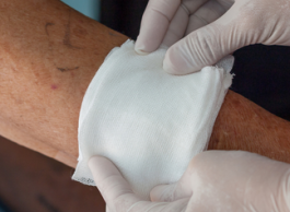 A wound being packed with gauze.